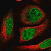 Anti-HOXC5 antibody produced in rabbit Prestige Antibodies® Powered by Atlas Antibodies, affinity isolated antibody, buffered aqueous glycerol solution
