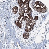 Anti-CALCOCO1 antibody produced in rabbit Prestige Antibodies® Powered by Atlas Antibodies, affinity isolated antibody, buffered aqueous glycerol solution