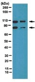 Anti-Amphiphysin II Antibody from rabbit, purified by affinity chromatography