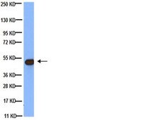 Anti-Tubulin Antibody, beta, clone KMX-1 clone KMX-1, Chemicon®, from mouse