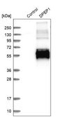 Anti-DPEP1 antibody produced in rabbit Prestige Antibodies® Powered by Atlas Antibodies, affinity isolated antibody, buffered aqueous glycerol solution