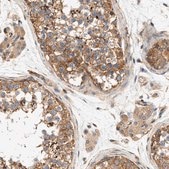 Anti-SEPT2 antibody produced in rabbit Prestige Antibodies® Powered by Atlas Antibodies, affinity isolated antibody, buffered aqueous glycerol solution