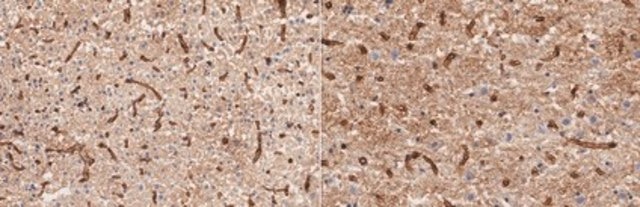Anti-Aquaporin-4 Antibody, clone mCCD clone mCCD, from mouse