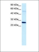 Anti-PARP1 antibody produced in rabbit IgG fraction of antiserum