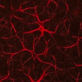 Anti-Neurofilament H Antibody Chemicon®, from chicken