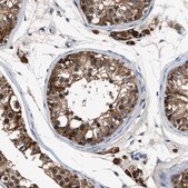 Anti-INHA antibody produced in rabbit Prestige Antibodies® Powered by Atlas Antibodies, affinity isolated antibody, buffered aqueous glycerol solution