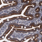 Anti-MRPL28 antibody produced in rabbit Prestige Antibodies® Powered by Atlas Antibodies, affinity isolated antibody, buffered aqueous glycerol solution