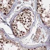 Anti-PRC1 antibody produced in rabbit Prestige Antibodies® Powered by Atlas Antibodies, affinity isolated antibody, buffered aqueous glycerol solution