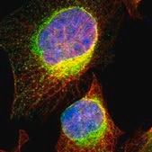 Anti-VAPA antibody produced in rabbit Prestige Antibodies® Powered by Atlas Antibodies, affinity isolated antibody, buffered aqueous glycerol solution