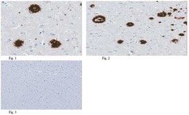 Anti-amyloid beta peptide (MOAB-2), pan Antibody, clone 6C3 clone 6C3, from mouse