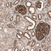 Anti-WASL antibody produced in rabbit Prestige Antibodies® Powered by Atlas Antibodies, affinity isolated antibody, buffered aqueous glycerol solution