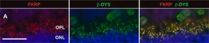 Anti-Collagen Antibody, Type IV Chemicon®, from rabbit