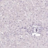 Anti-AGR3 antibody produced in rabbit Prestige Antibodies® Powered by Atlas Antibodies, affinity isolated antibody, buffered aqueous glycerol solution
