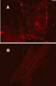 LentiBrite RFP-&#946;-actin Lentiviral Biosensor