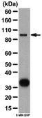 Anti-Autotaxin Antibody from rabbit, purified by affinity chromatography