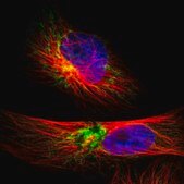 抗TIMM9抗体 ウサギ宿主抗体 Prestige Antibodies® Powered by Atlas Antibodies, affinity isolated antibody, buffered aqueous glycerol solution