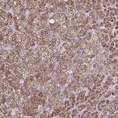 Anti-CYP11A1 antibody produced in rabbit Prestige Antibodies® Powered by Atlas Antibodies, affinity isolated antibody, buffered aqueous glycerol solution