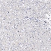 Anti-RSPH4A antibody produced in rabbit Prestige Antibodies® Powered by Atlas Antibodies, affinity isolated antibody, buffered aqueous glycerol solution