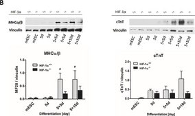 抗ビンキュリン抗体、モウスモノクローナル clone hVIN-1, purified from hybridoma cell culture