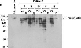 抗フィブロネクチン ウサギ宿主抗体 affinity isolated antibody, buffered aqueous solution