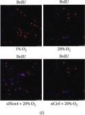 抗BrdU抗体、マウスモノクローナル clone BU-33, purified from hybridoma cell culture