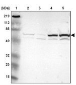 Anti-TXNRD1 antibody produced in rabbit Prestige Antibodies® Powered by Atlas Antibodies, affinity isolated antibody, buffered aqueous glycerol solution