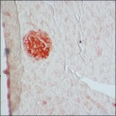Anti-Glutamic Acid Decarboxylase 65/67 antibody produced in rabbit IgG fraction of antiserum, buffered aqueous solution