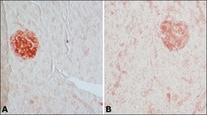 Anti-Glutamic Acid Decarboxylase 65/67 antibody produced in rabbit IgG fraction of antiserum, buffered aqueous solution