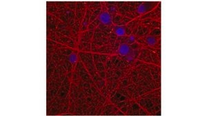 Anti-α-Synuclein Antibody, clone 2F12 clone 2F12, from mouse