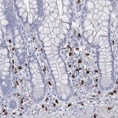 Anti-VPS13D antibody produced in rabbit Prestige Antibodies® Powered by Atlas Antibodies, affinity isolated antibody, buffered aqueous glycerol solution