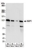 Rabbit anti-KAP-1 Antibody, Affinity Purified Powered by Bethyl Laboratories, Inc.