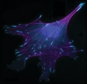 モノクロナール抗ビンキュリン マウス宿主抗体 clone VIN-11-5, ascites fluid