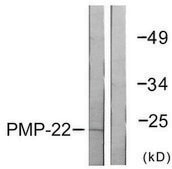 Anti-PMP22 antibody produced in rabbit affinity isolated antibody