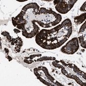 Anti-ACADS antibody produced in rabbit Prestige Antibodies® Powered by Atlas Antibodies, affinity isolated antibody, buffered aqueous glycerol solution, Ab2