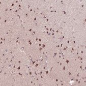 Anti-CHMP4B antibody produced in rabbit Prestige Antibodies® Powered by Atlas Antibodies, affinity isolated antibody, buffered aqueous glycerol solution