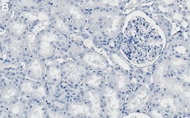 Anti-PI-3 kinase p110α Antibody, clone 1J4 ZooMAb® Rabbit Monoclonal recombinant, expressed in HEK 293 cells