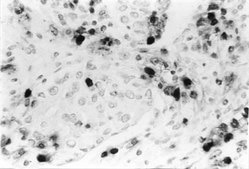 Anti-DNA Antibody, single stranded specific, clone F7-26 clone F7-26, Chemicon®, from mouse