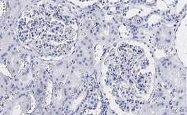 Anti-Vimentin Antibody, clone 2I13 ZooMAb® Rabbit Monoclonal recombinant, expressed in HEK 293 cells