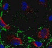 Anti-alpha-Actin Antibody, Smooth Muscle from rabbit, purified by affinity chromatography