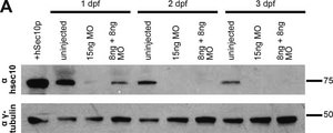 抗γ-チューブリン ウサギ宿主抗体 affinity isolated antibody, buffered aqueous solution
