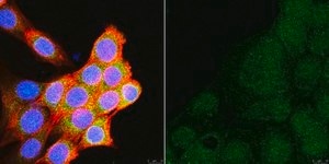 Anti-Rac1b Antibody Upstate®, from rabbit