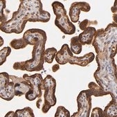Anti-CFB antibody produced in rabbit Ab3, Prestige Antibodies® Powered by Atlas Antibodies, affinity isolated antibody, buffered aqueous glycerol solution