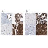 Anti-CALD1 antibody produced in rabbit Ab1, Prestige Antibodies® Powered by Atlas Antibodies, affinity isolated antibody, buffered aqueous glycerol solution