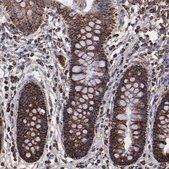 抗SOD2抗体 ウサギ宿主抗体 Prestige Antibodies® Powered by Atlas Antibodies, affinity isolated antibody, buffered aqueous glycerol solution