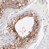 Anti-SLC16A1 antibody produced in rabbit Prestige Antibodies® Powered by Atlas Antibodies, affinity isolated antibody, buffered aqueous glycerol solution
