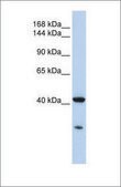 Anti-GNAS antibody produced in rabbit affinity isolated antibody