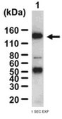 Anti-iNOS/NOS II Antibody, NT from rabbit, purified by affinity chromatography