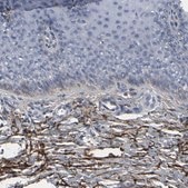 Anti-VCAN antibody produced in rabbit Prestige Antibodies® Powered by Atlas Antibodies, affinity isolated antibody, buffered aqueous glycerol solution