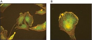 Anti-ARP3 antibody, Mouse monoclonal clone FMS338, purified from hybridoma cell culture