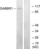 Anti-GABBR1 antibody produced in rabbit affinity isolated antibody
